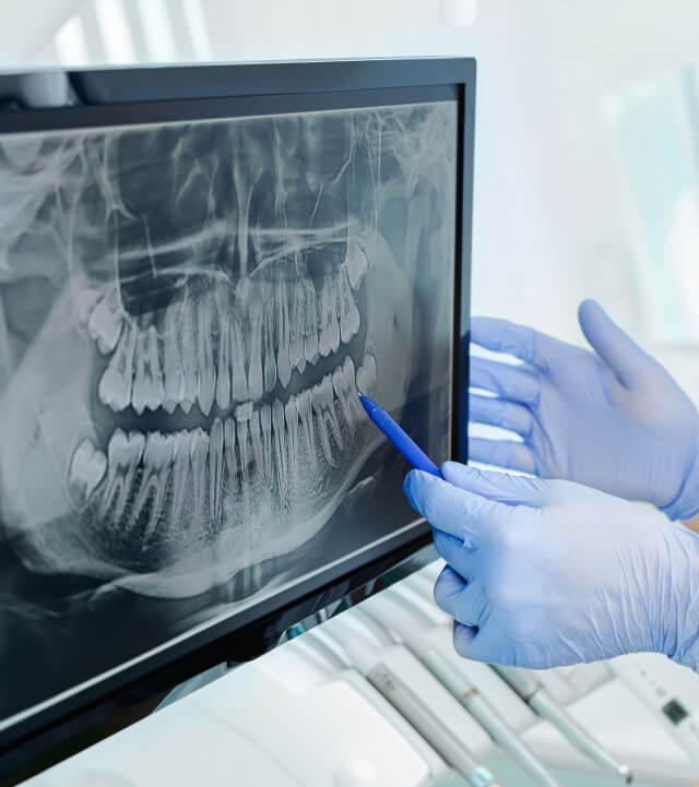 dental x-rays