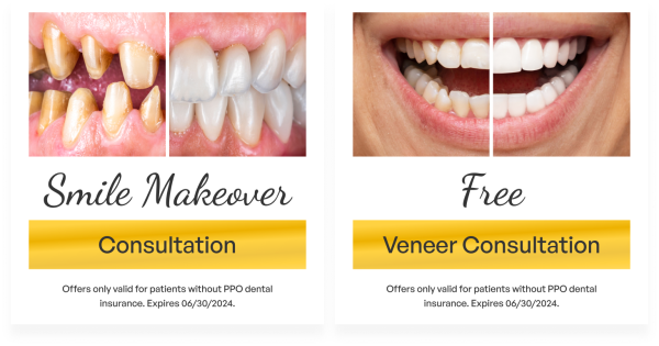 Free smile makeover or free veneer consultation